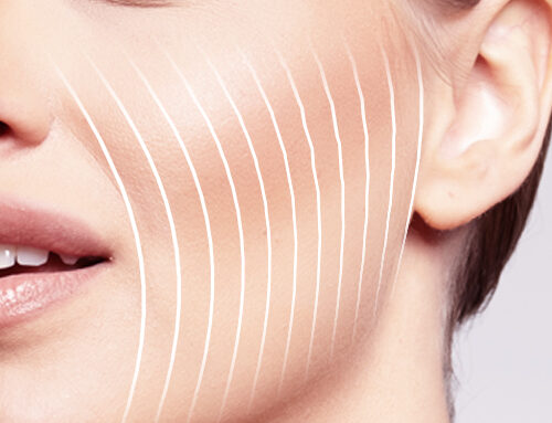 Botox vs botoxszerű